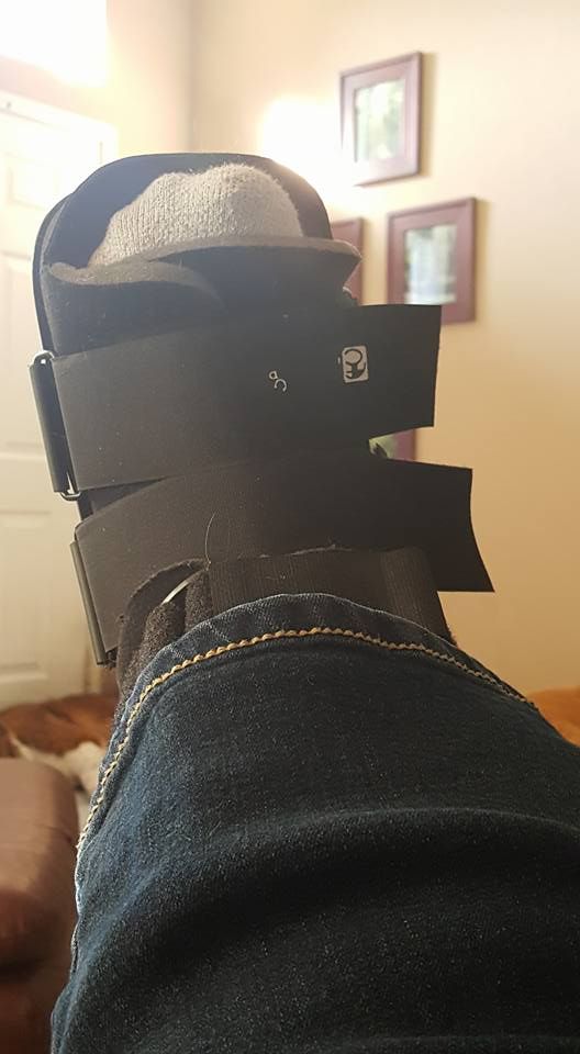  photo stress fracture june 2016_zpszo49usxq.jpg